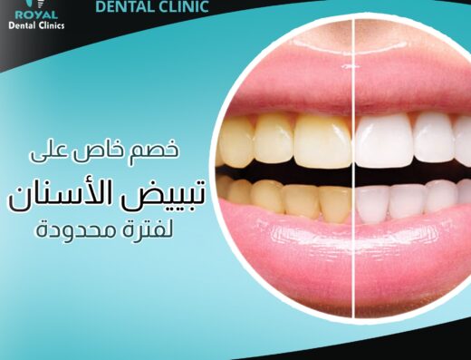 رويال لطب الاسنان بالسويس