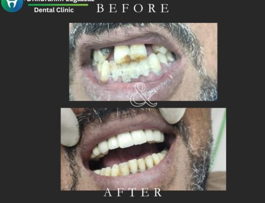 DR . Ibrahim Elgazzaz