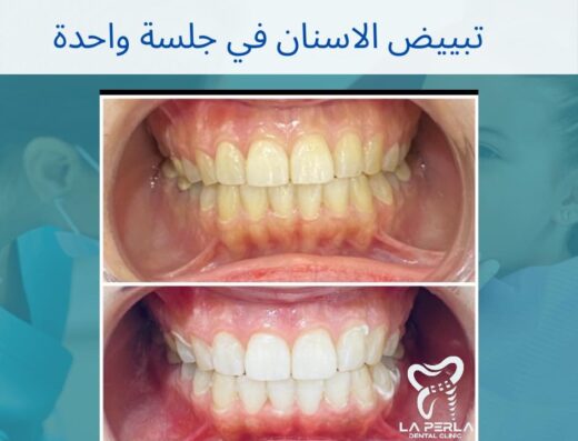 La Perla Dental Clinic Dr.Nehal Ibrahim