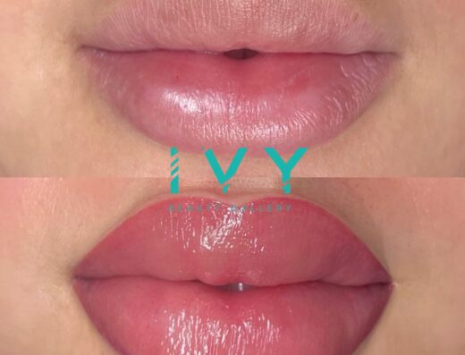 ivybeautygallery
