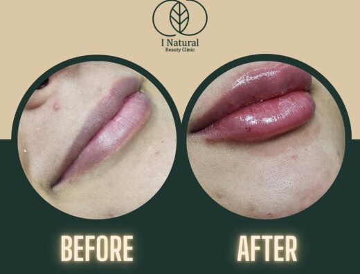 I Natural Beauty Clinic