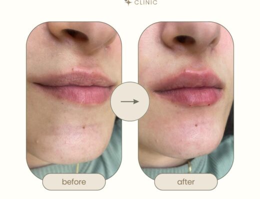 Glow Clinic