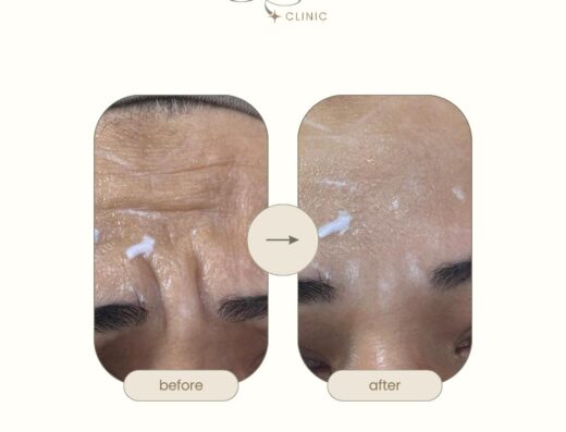 Glow Clinic