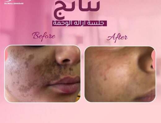 د. منى عبداللطيف